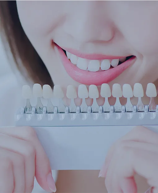 치아미백 색상 비교(자료 이미지)