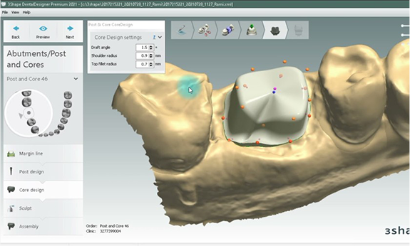 디지털 3D CT 촬영 장비